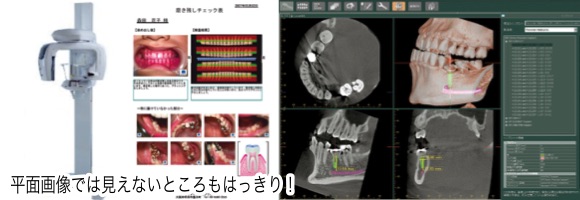 歯科用CTの写真